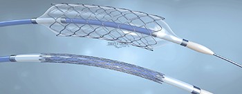 Precision Cutting Stents with Fiber Lasers